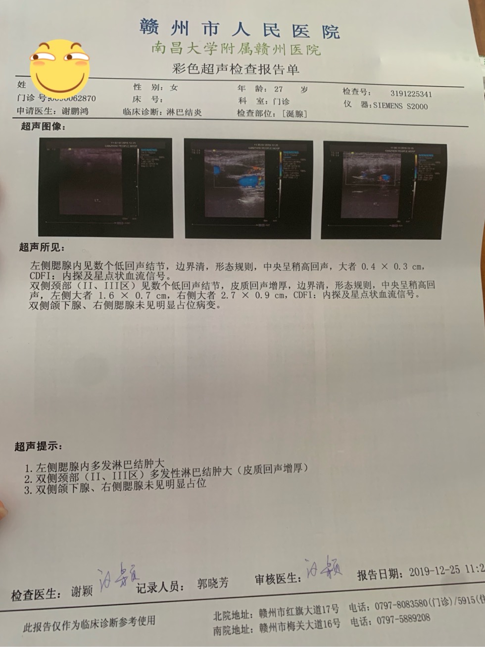 183528uvhacr1hke7135cc.jpg