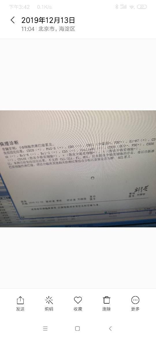 154823gz61ilf3xz535534.png