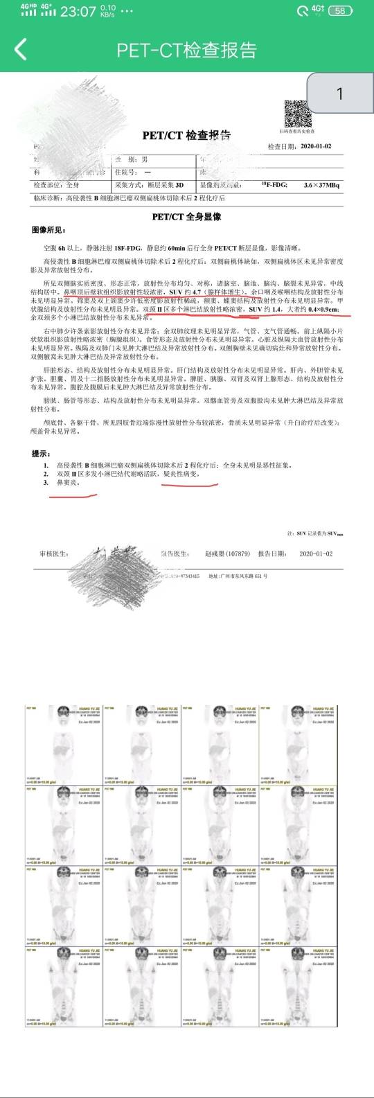 171210m1fax91cjzqfoqi5.jpg