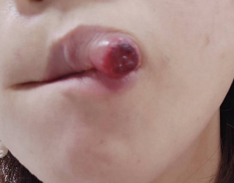 124855y2dgmcsym9hpzbam.jpg