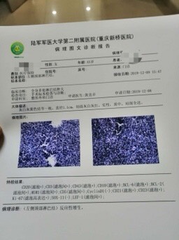 154922it28opde2o6dt2ys.jpg