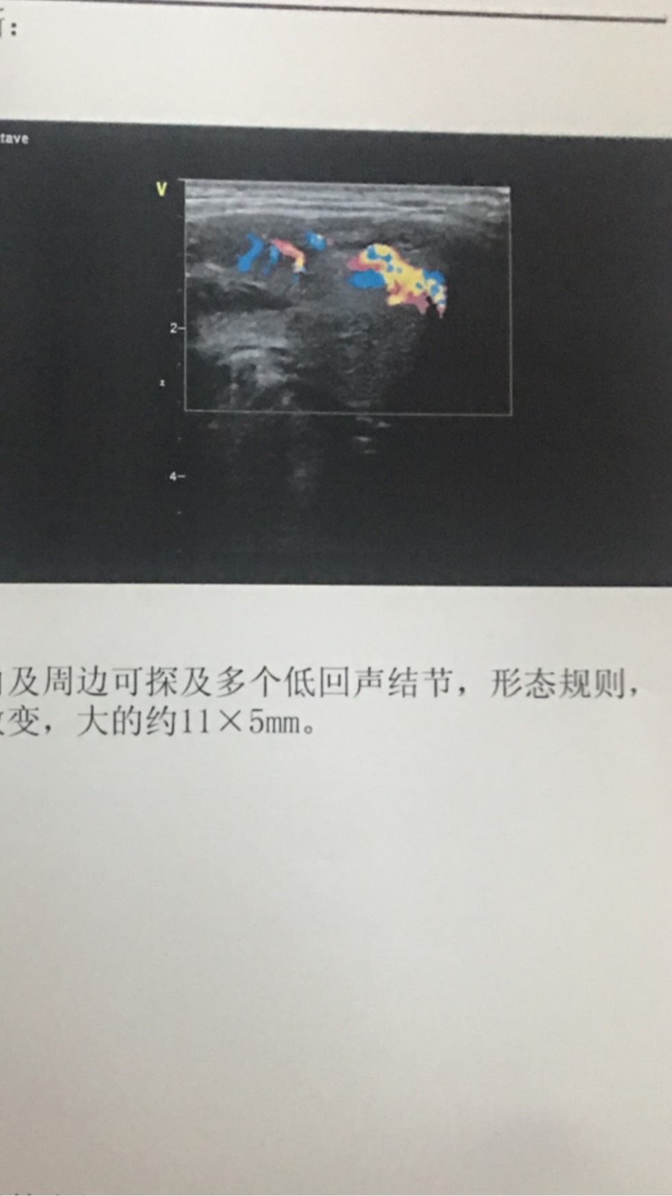 135446wp4pe8jwzyi5e4pd.jpg