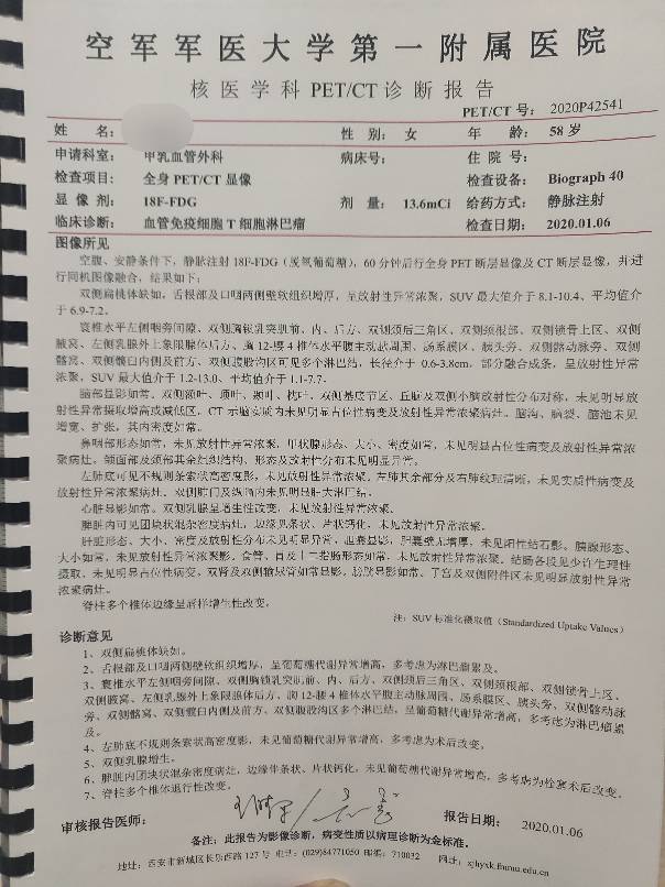 190355vc86cp6wvyvtctsc.jpg