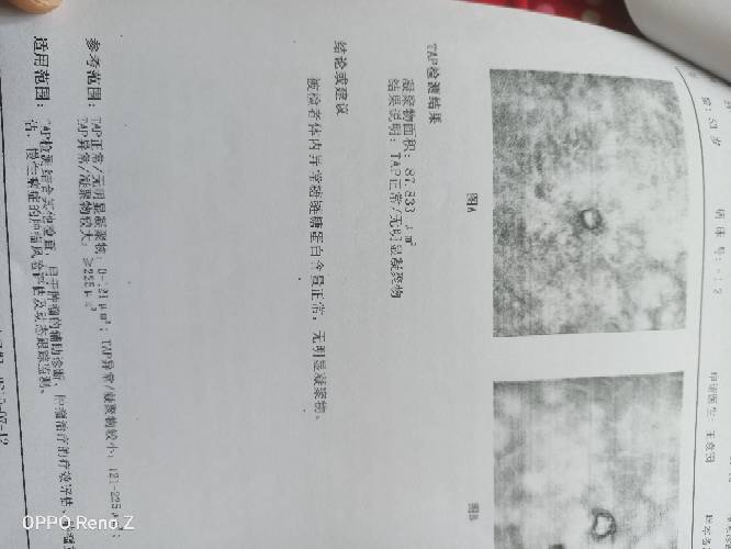 125339z3xor838jj4jlxwl.jpg