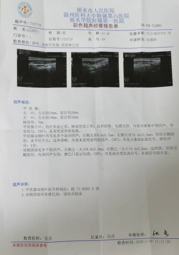 084155mm37s5ufw8bew3sp.jpg