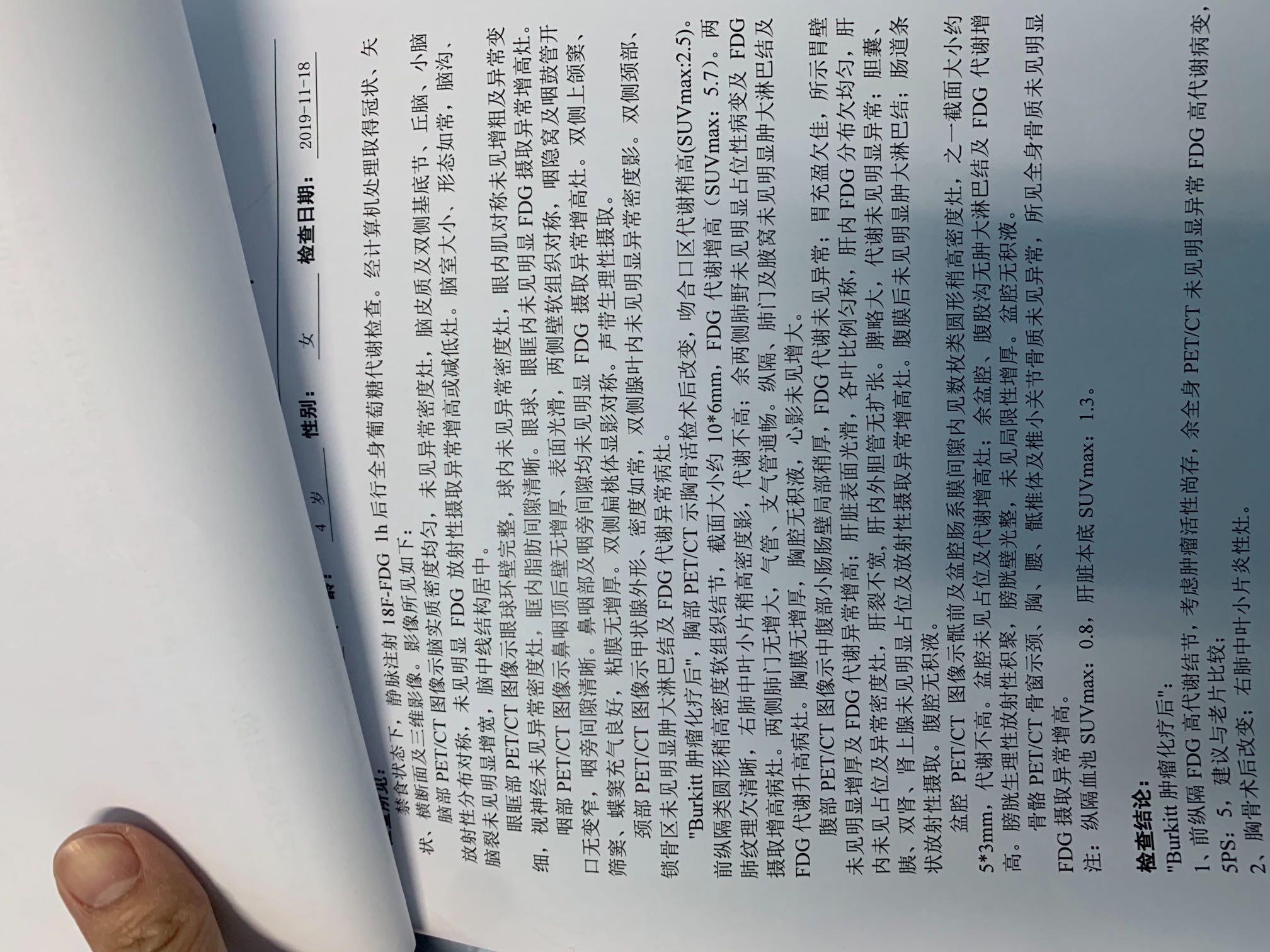 143045rz7st5iri97i5470.jpeg