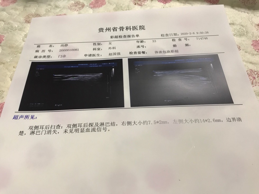 171325uiv6s34948nni91n.jpg