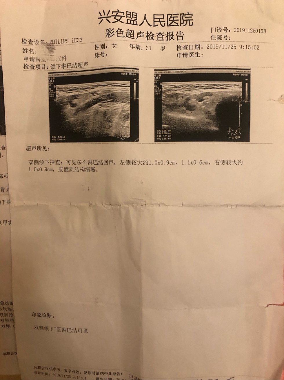 211533cto0xaztf88o2zmo.jpg
