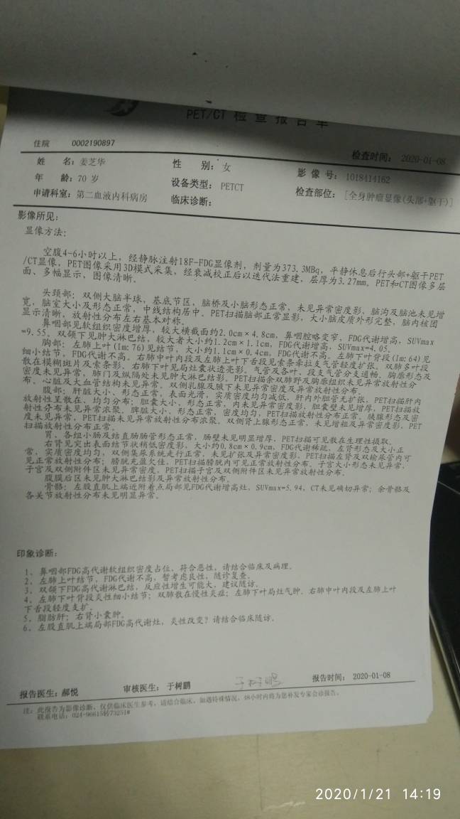 160120ykcoczsomo0sccwt.jpg