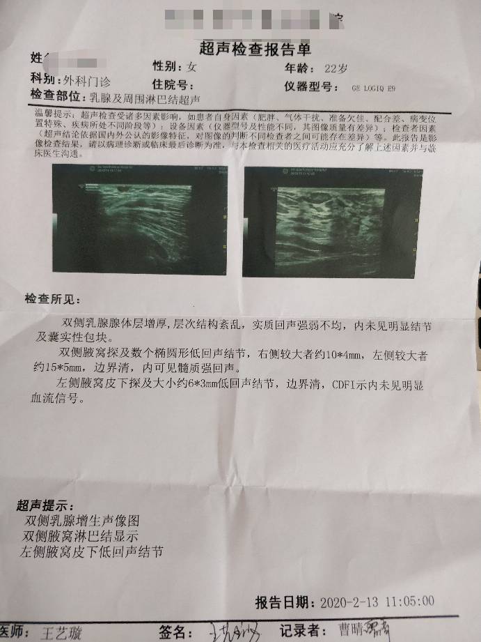 174002zze39v9g3nt9960l.jpg