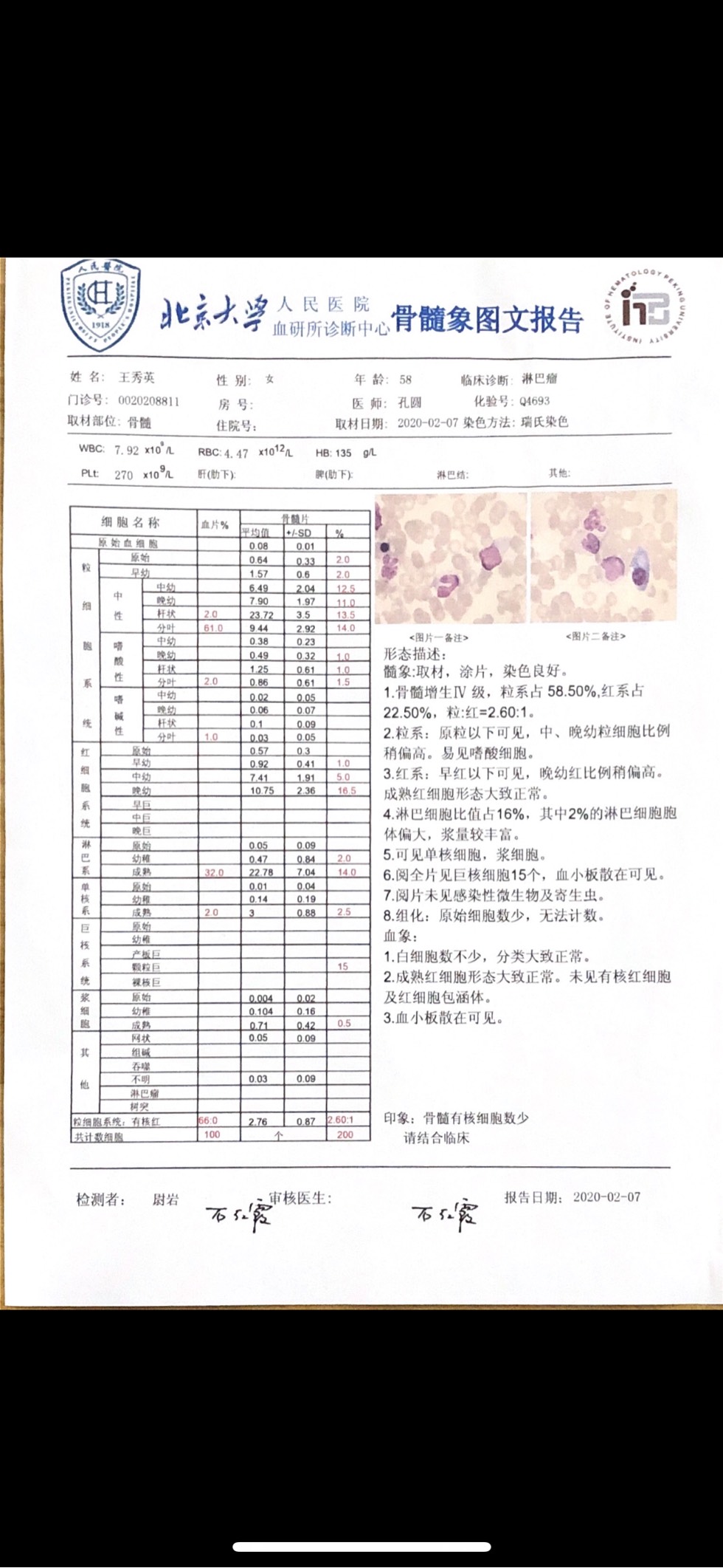 111139fpn1yq2pdpeqb5x1.jpg