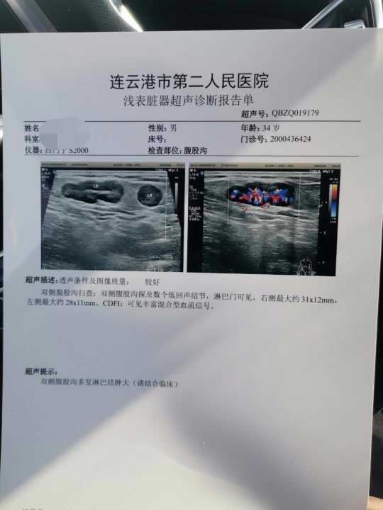 153427qjglli6a98j76lt8.JPG