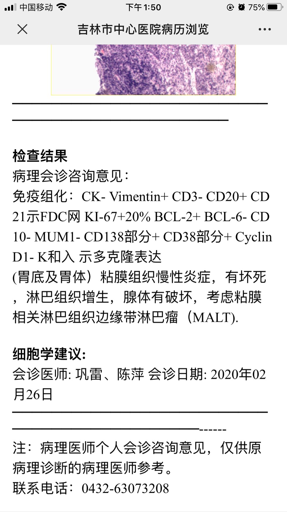 094952qaulmyy0zemcc0xt.jpg