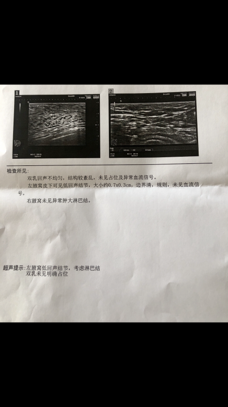 3A4D4CCA-61B4-45C5-BBFD-44B91E818CB0.png
