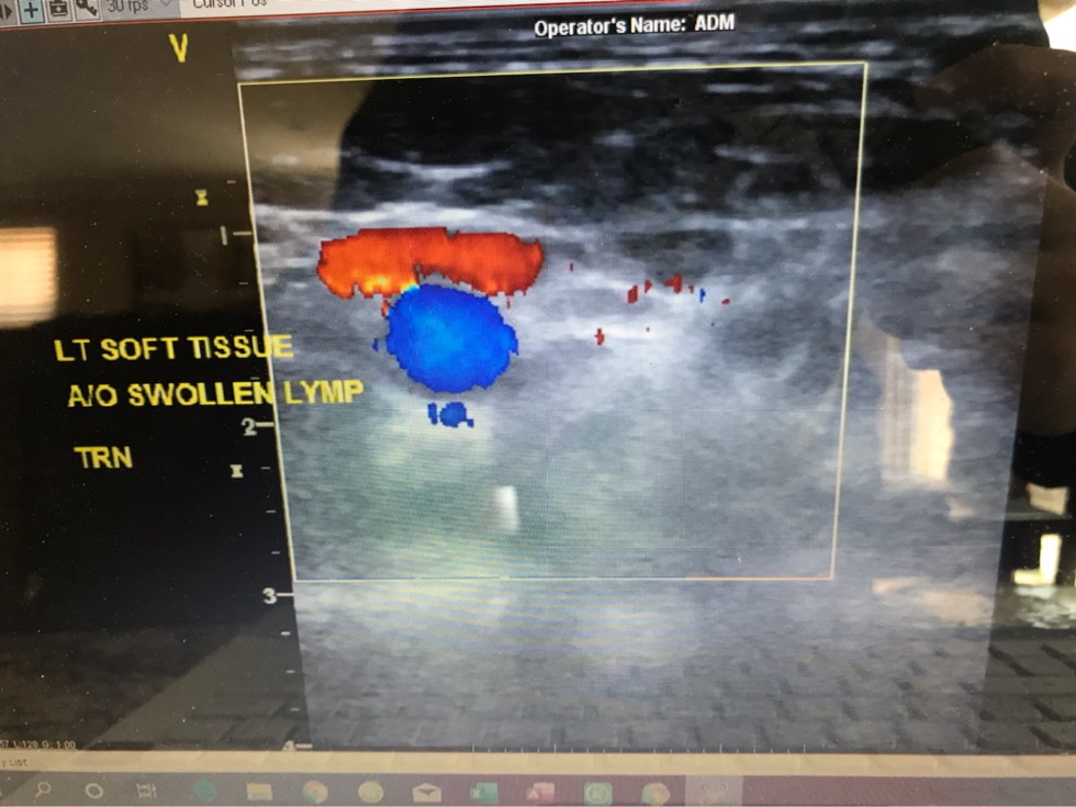 061816lecy9mqs3wq1ivt3.jpg