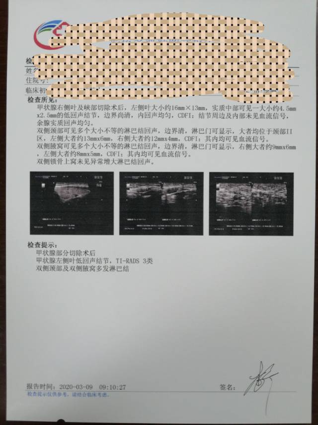 095344exk1uet2t0t69kuu.jpg