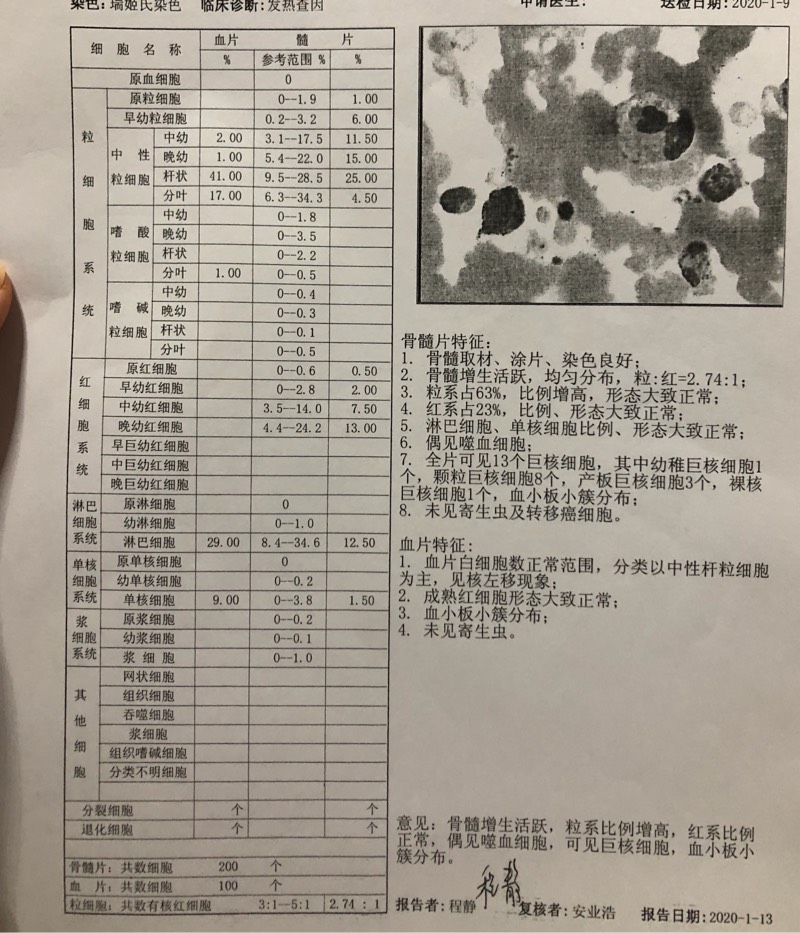 123952it8gp7p1akta21at.jpg