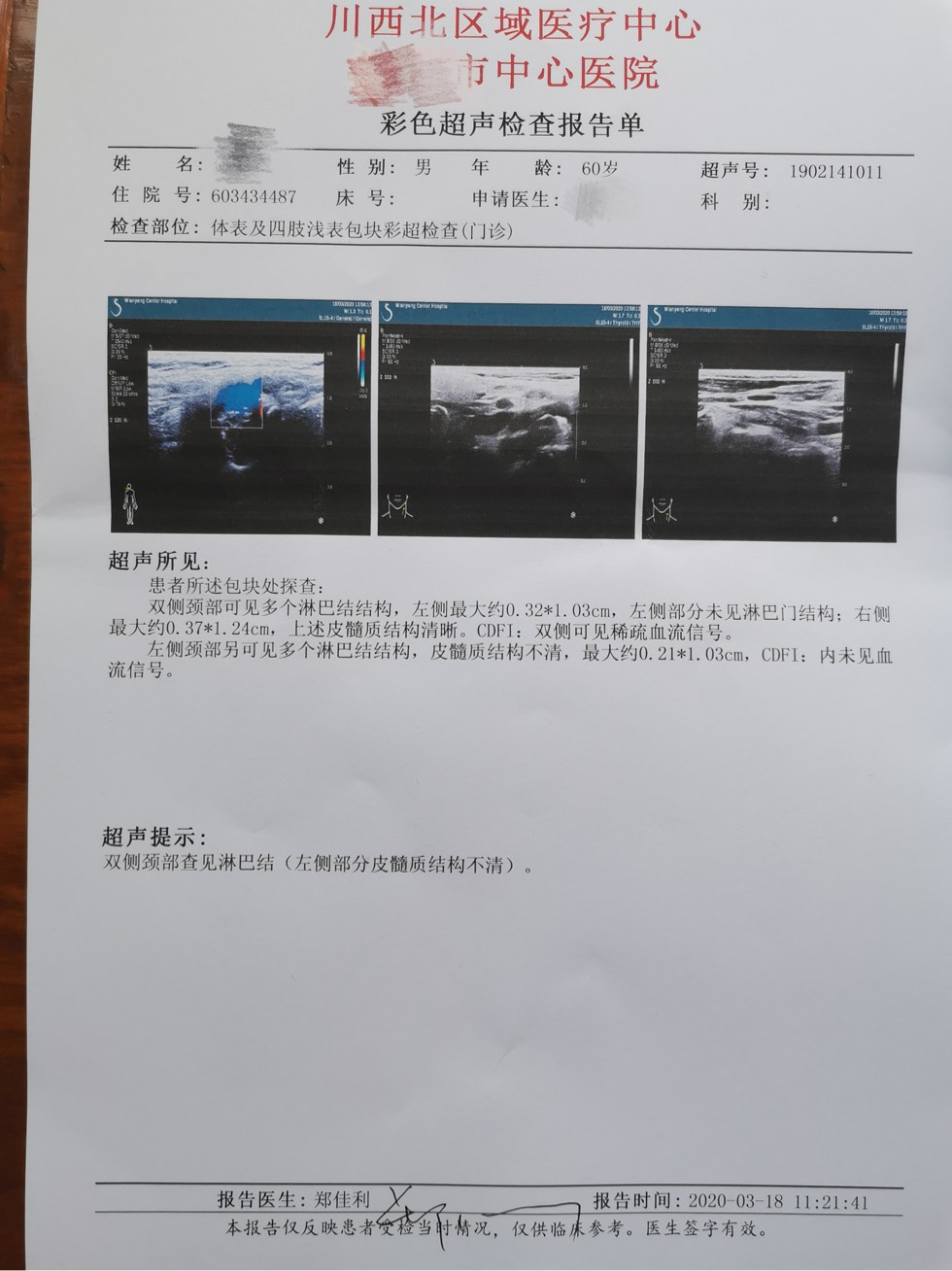 结疗后淋巴结肿大