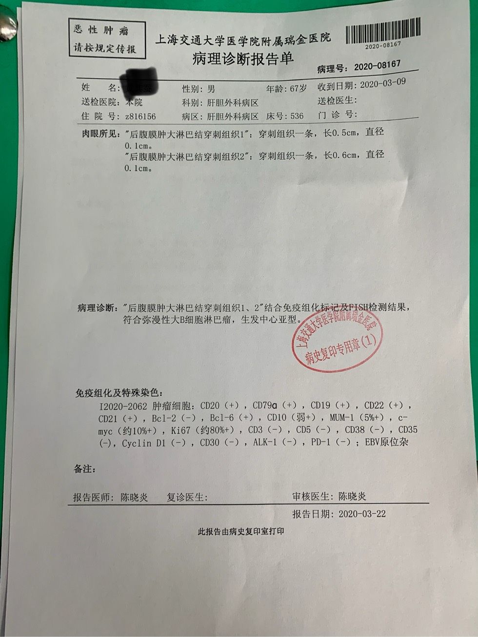 拜托大家帮我看看弥漫型大b淋巴癌病理报告