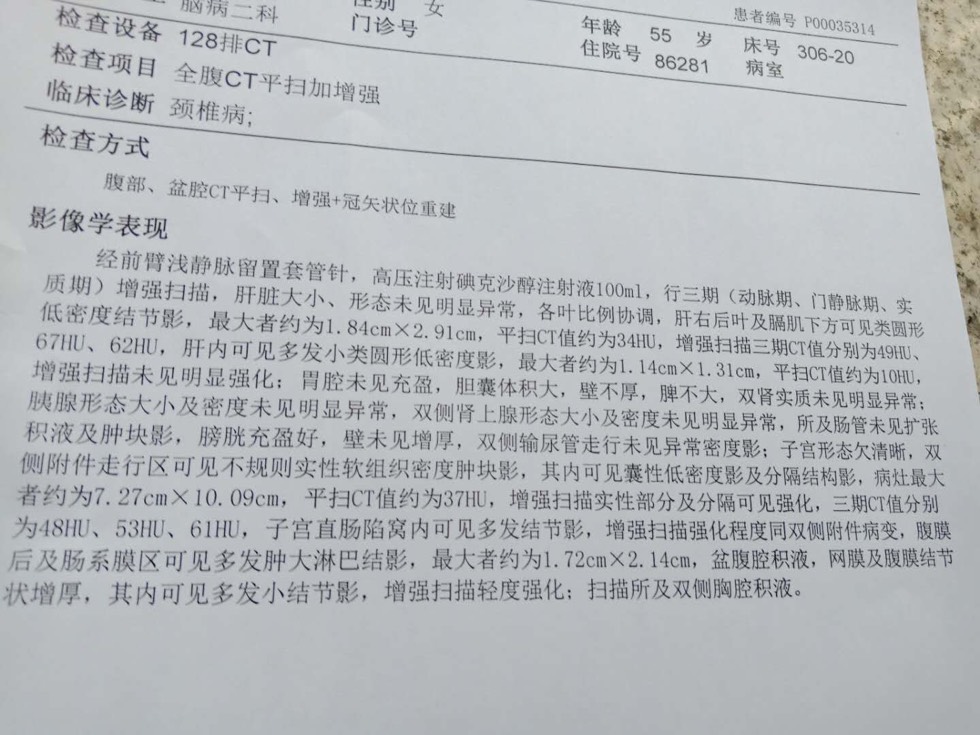 172322gicscwpjnc21qpc5.jpg