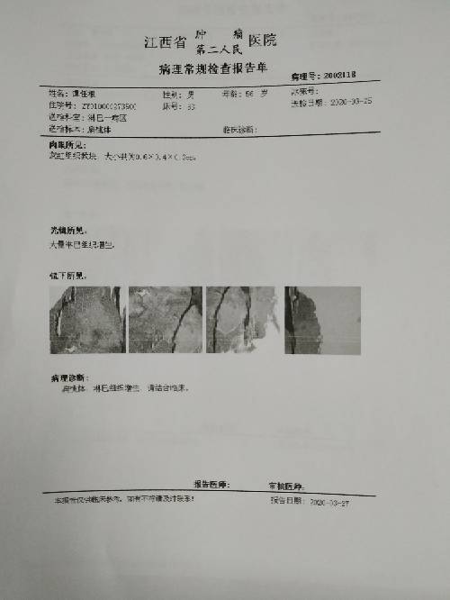 161103msc73bvgexllvcxb.jpg