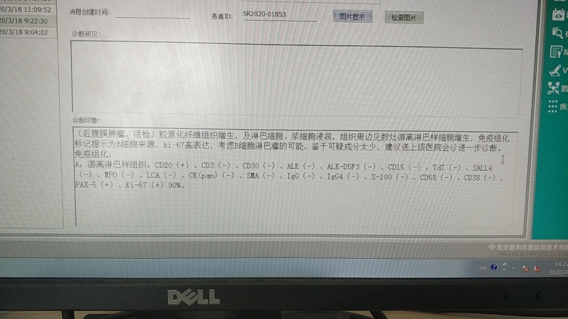 宁波病理中心电脑报告.jpg