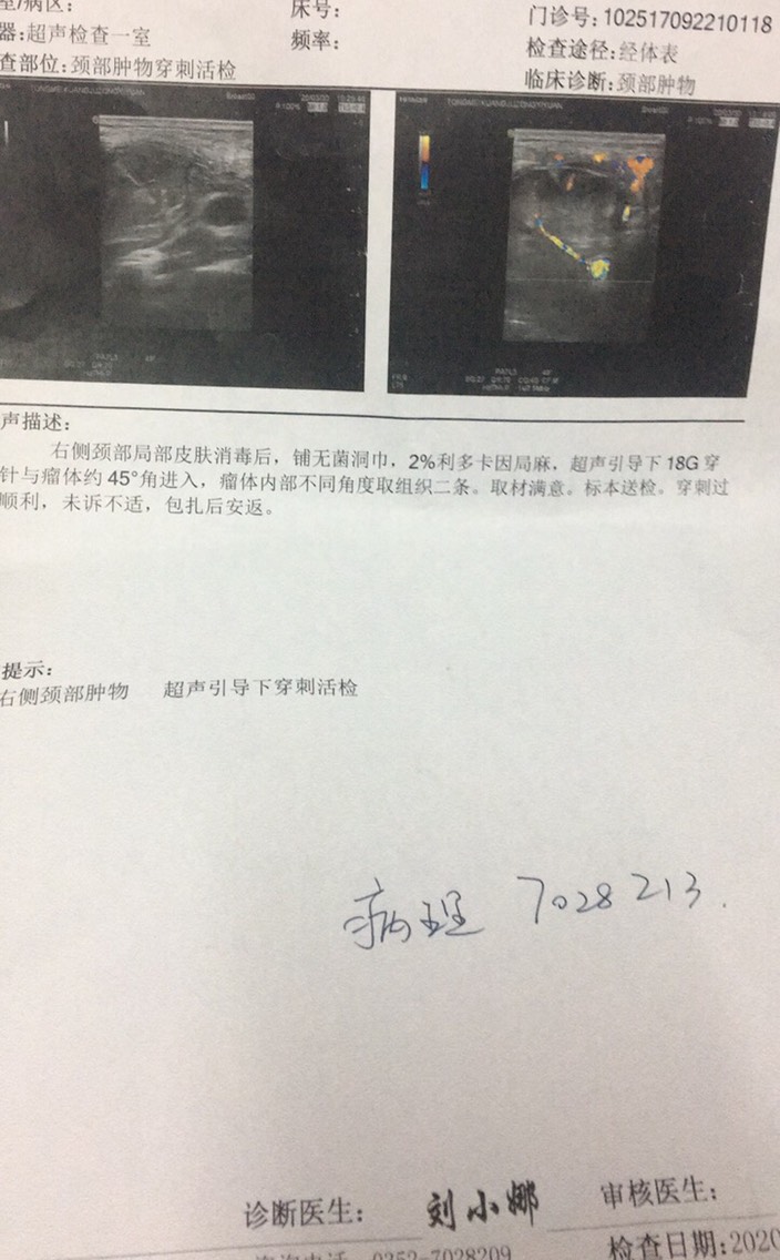 080948ktcri6c583hhj6bt.jpg