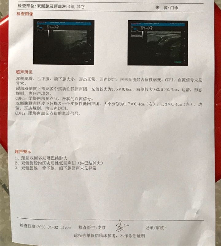 87152E22-D040-4001-9451-0F110D6688C7.jpeg