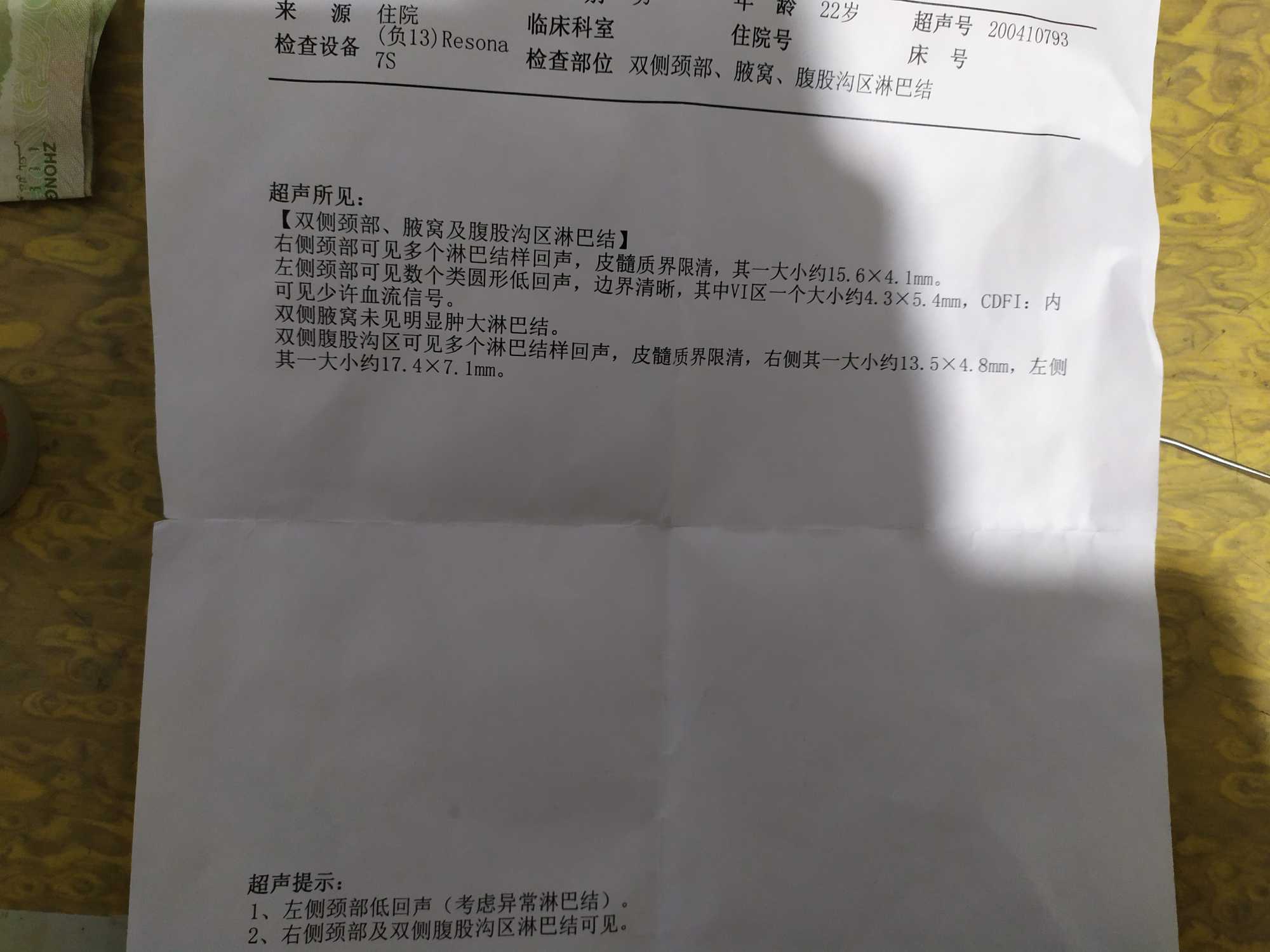 193636nw8574w5qr81hu21.jpg