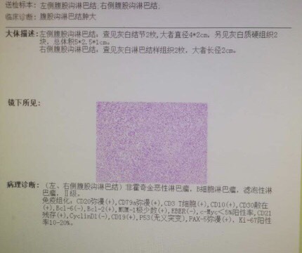 073634wvjvvfz84jzghcer.jpg