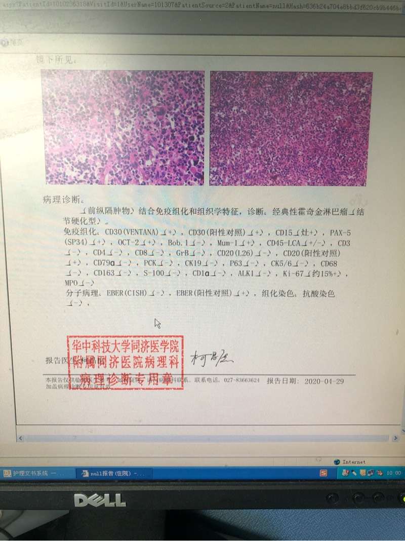 095250bh7de2omz641447s.jpg