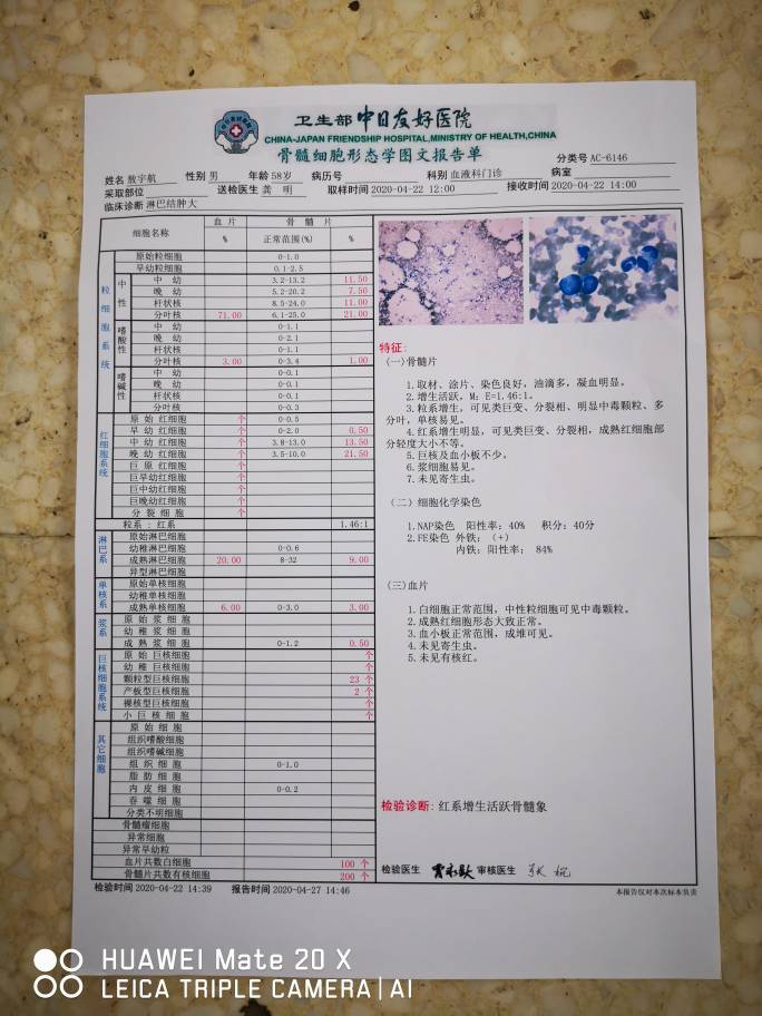 184605ajcb5rqbhvoqap5b.jpg