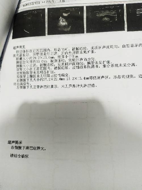 192043rrplncsrrr2fu620.jpg