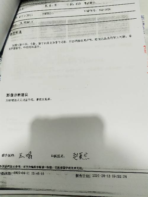 192043zvlmxrndwb97bdlp.jpg