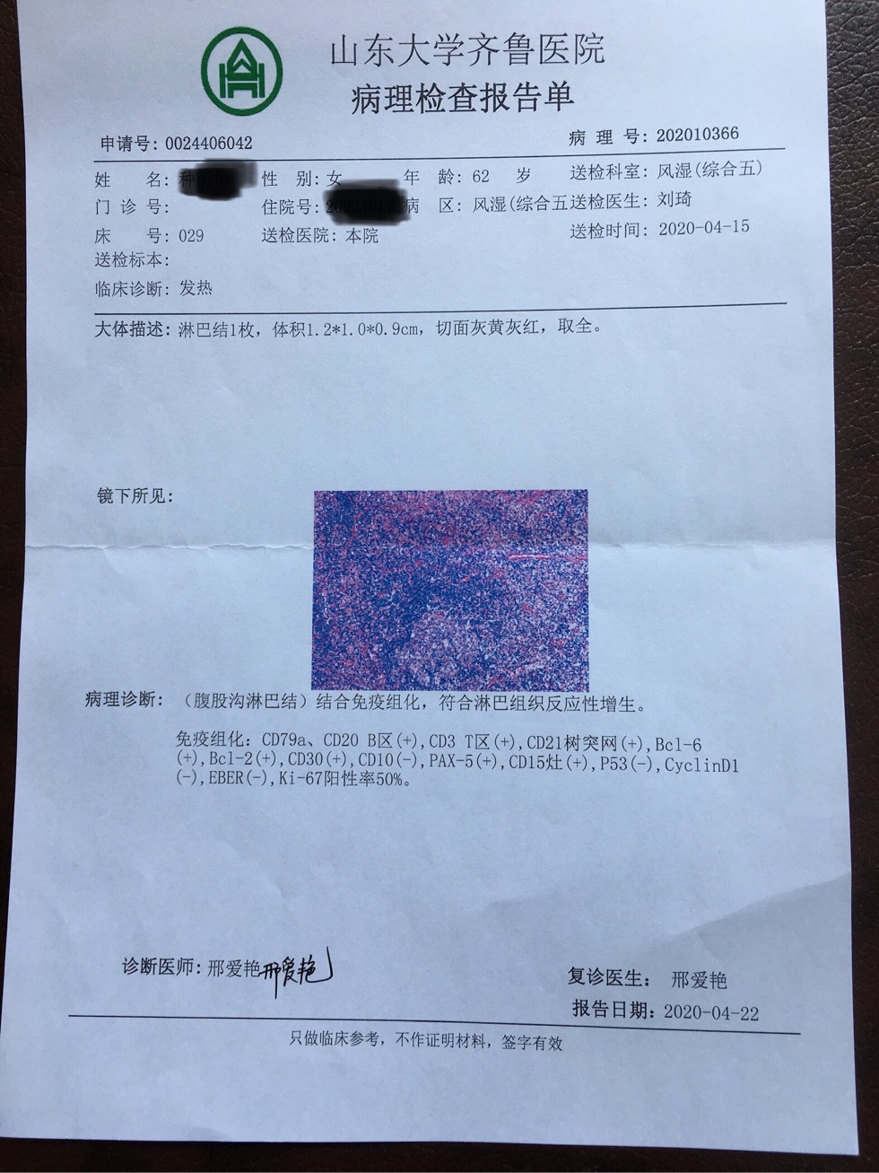 161101sv1jkci98kk1vzq1.jpg