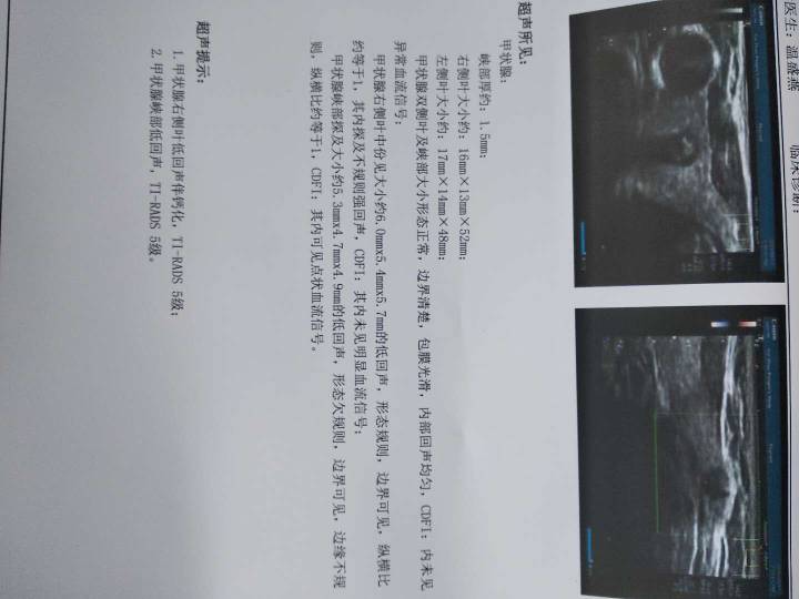 233101wu251utmxst14tx8.jpg