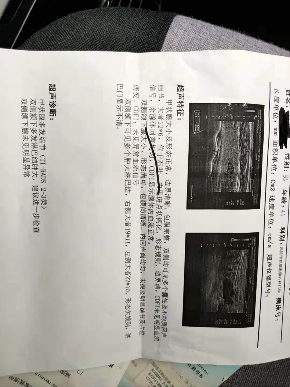 190411kd21m7emi1kp6uue.jpg