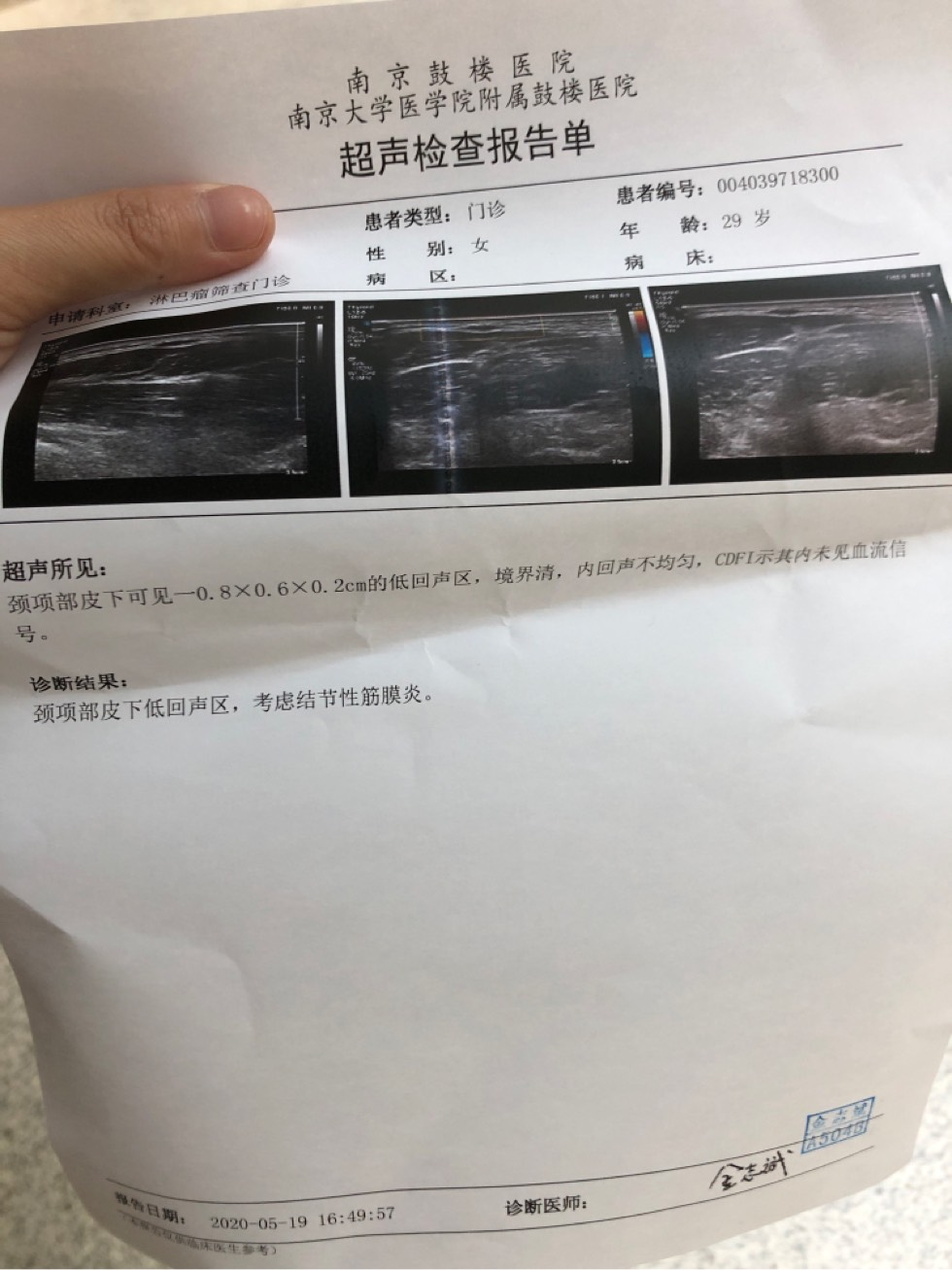 171321fu90rd47t4unwxxp.jpg