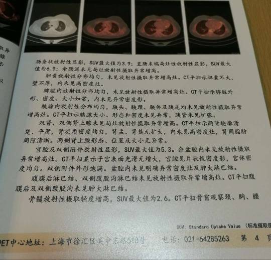 105631t2d9ttd9i9j9iyoi.jpg