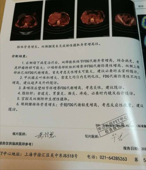 105632j191hod9uzg9zj4h.jpg