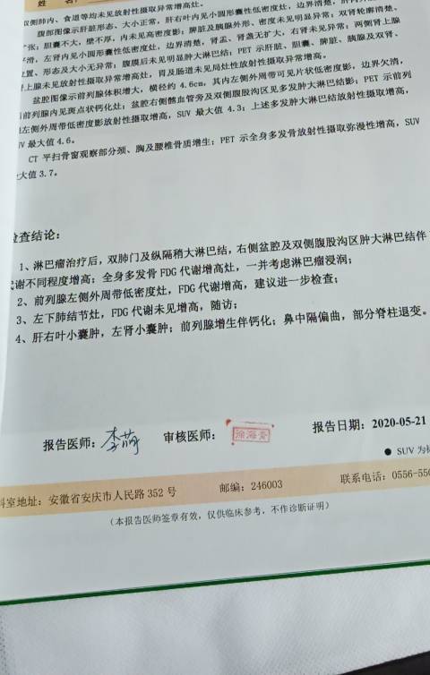 172057npmo5ppd5pm5dd8p.jpg