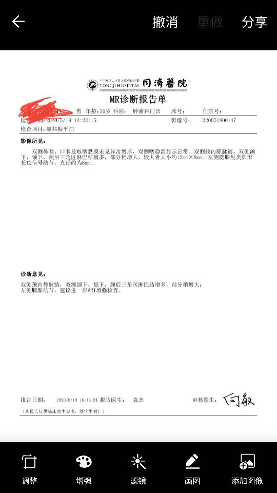 131547wsxyxxax9t3xwfzh.png