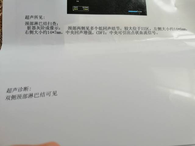 173506q0fn1g03vjhib53v.jpg