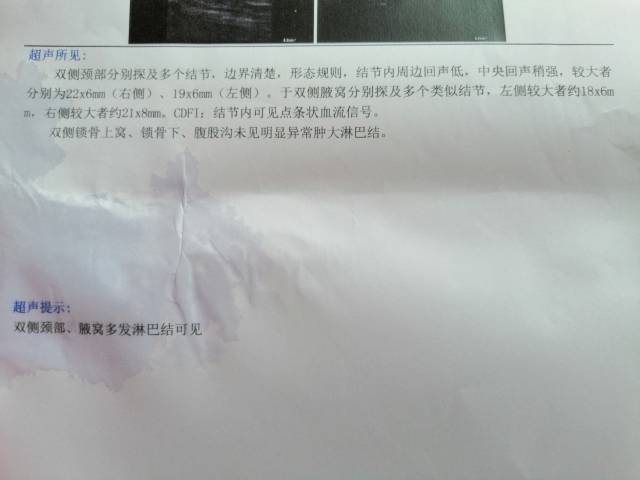 173506vrmk8ckj3wf8r8jn.jpg