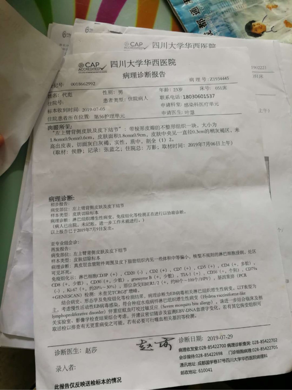 173626e22gnkn4kuk4npku.jpg