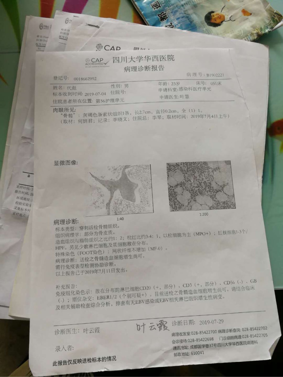 173630n6m4vu4cuui6zo2u.jpg