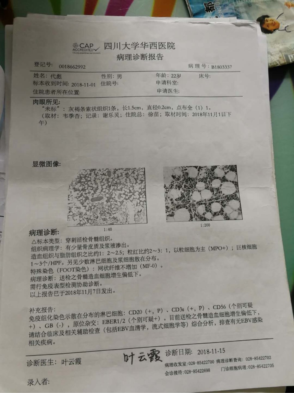 173639xad9jmd00gm60mdm.jpg