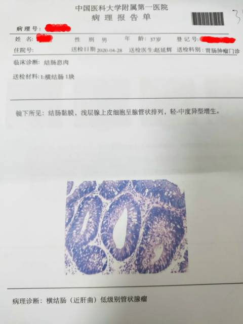222404ixm9qxz9u9t588yq.jpg
