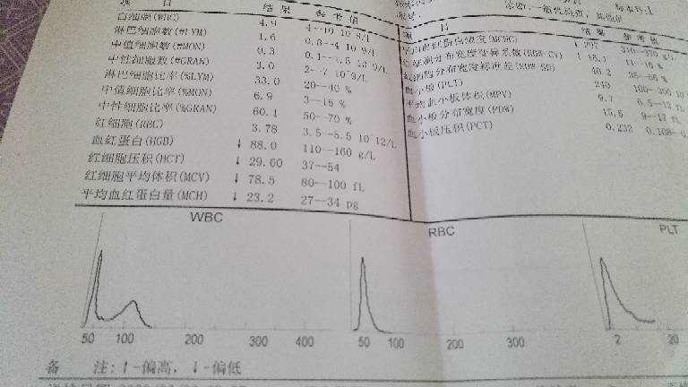 172553sj38i8i4vc35qfbb.jpg