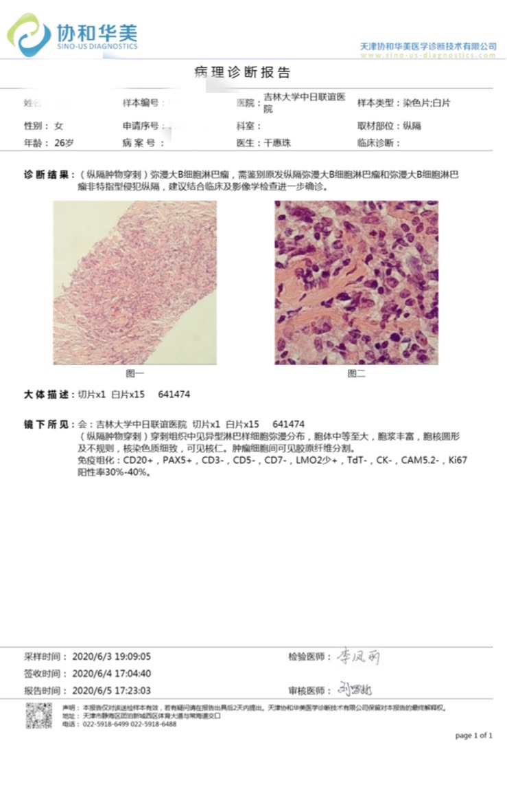 084225egf7lmzldmqfwall.jpg